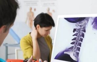 Traitement d'ostéochondose cervicale